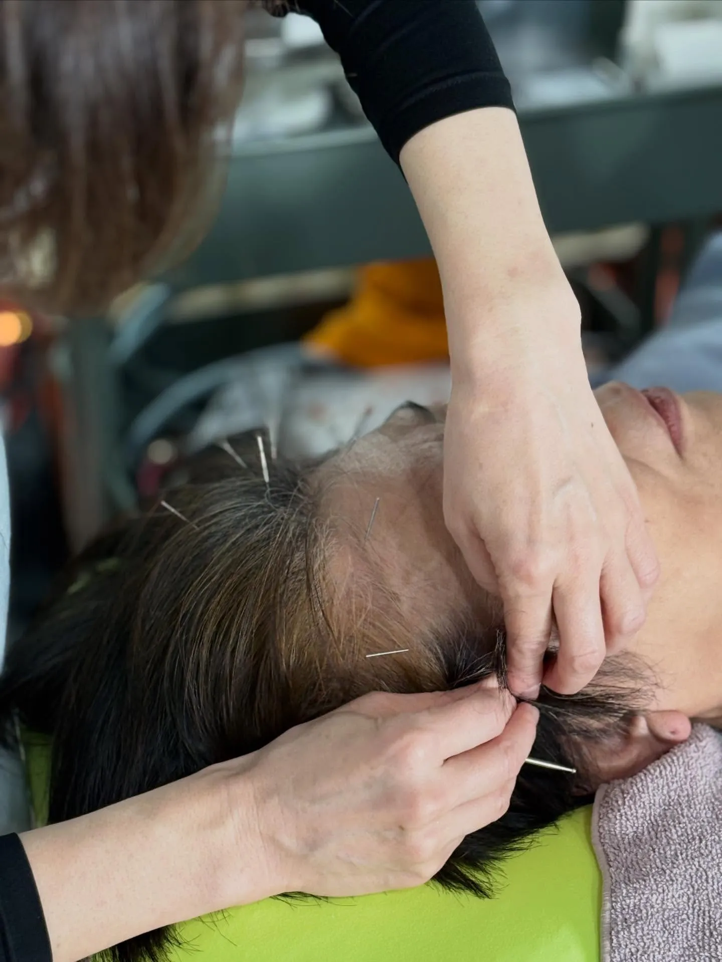 【量子空間で鍼灸施術🪡🔥相乗効果で血流UP】