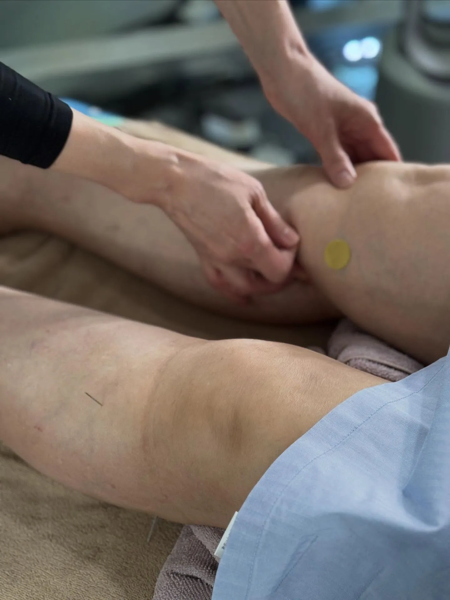 【量子空間で鍼灸施術🪡🔥相乗効果で血流UP】